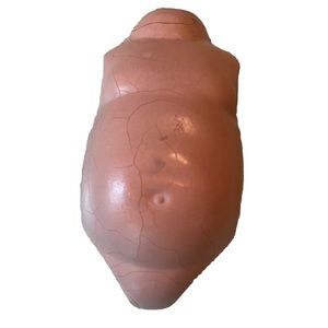 Vintage Composition Doll Body For 16-18 Inch Dolls For Repair Replacement Part